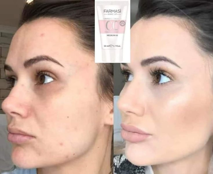 سی سی کرم فارماسی حجم 50 میل مناسب انواع پوست